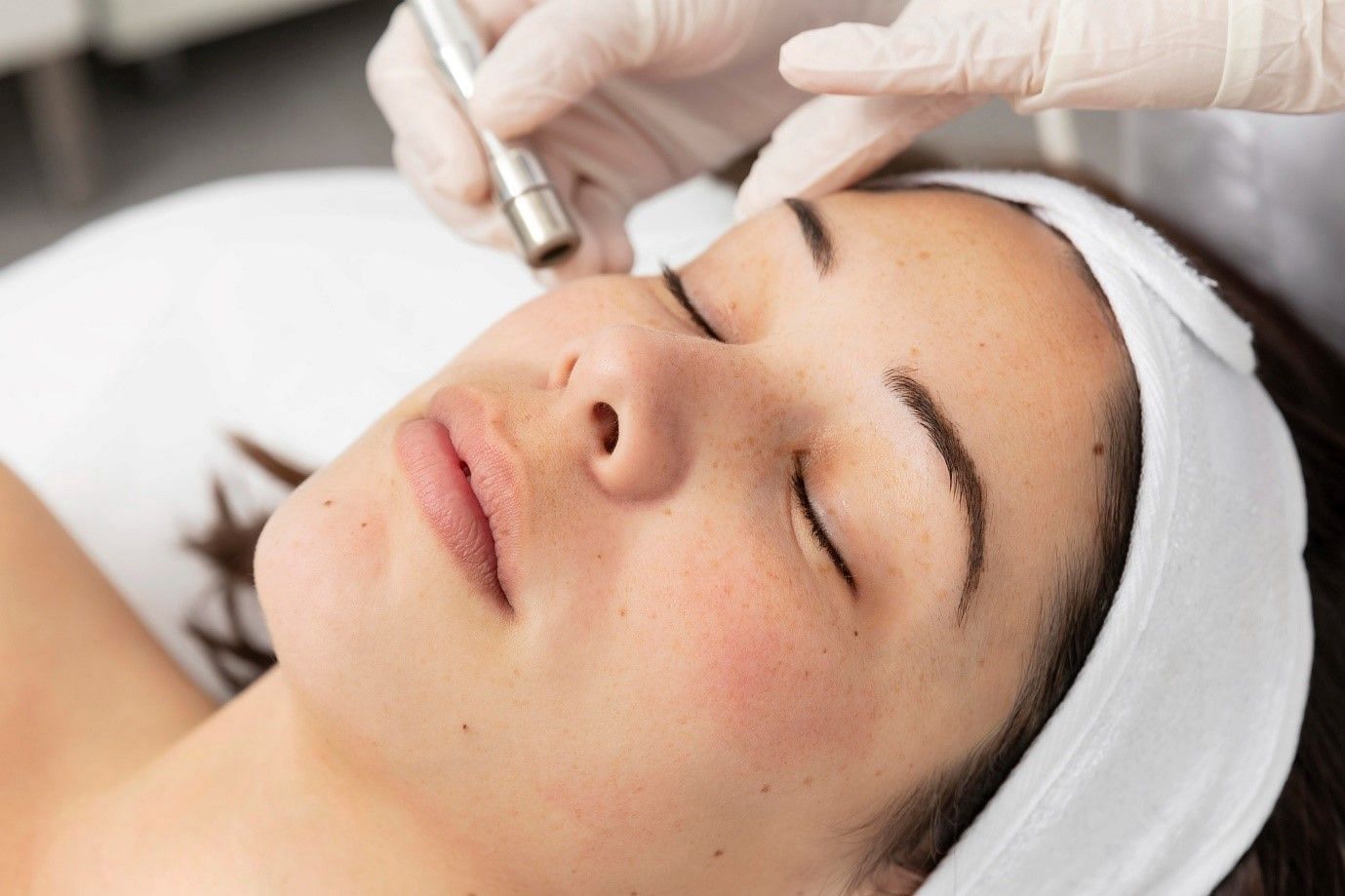 Excess melanin production causes the development of brown spots (image by freepik on freepik)